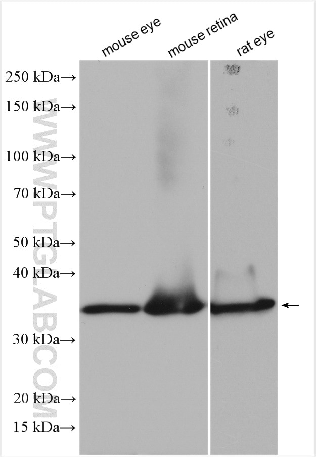 Western Blot (WB) analysis of various lysates using RLBP1 Polyclonal antibody (15356-1-AP)