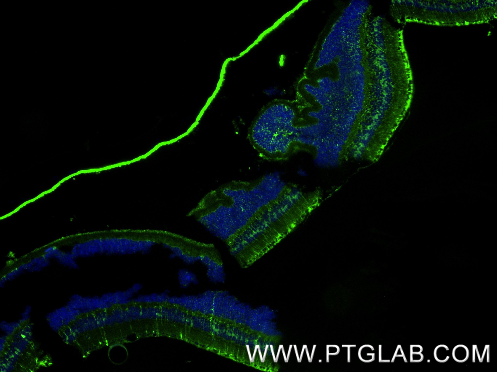 Immunofluorescence (IF) / fluorescent staining of mouse eye tissue using RLBP1 Recombinant antibody (85697-1-RR)