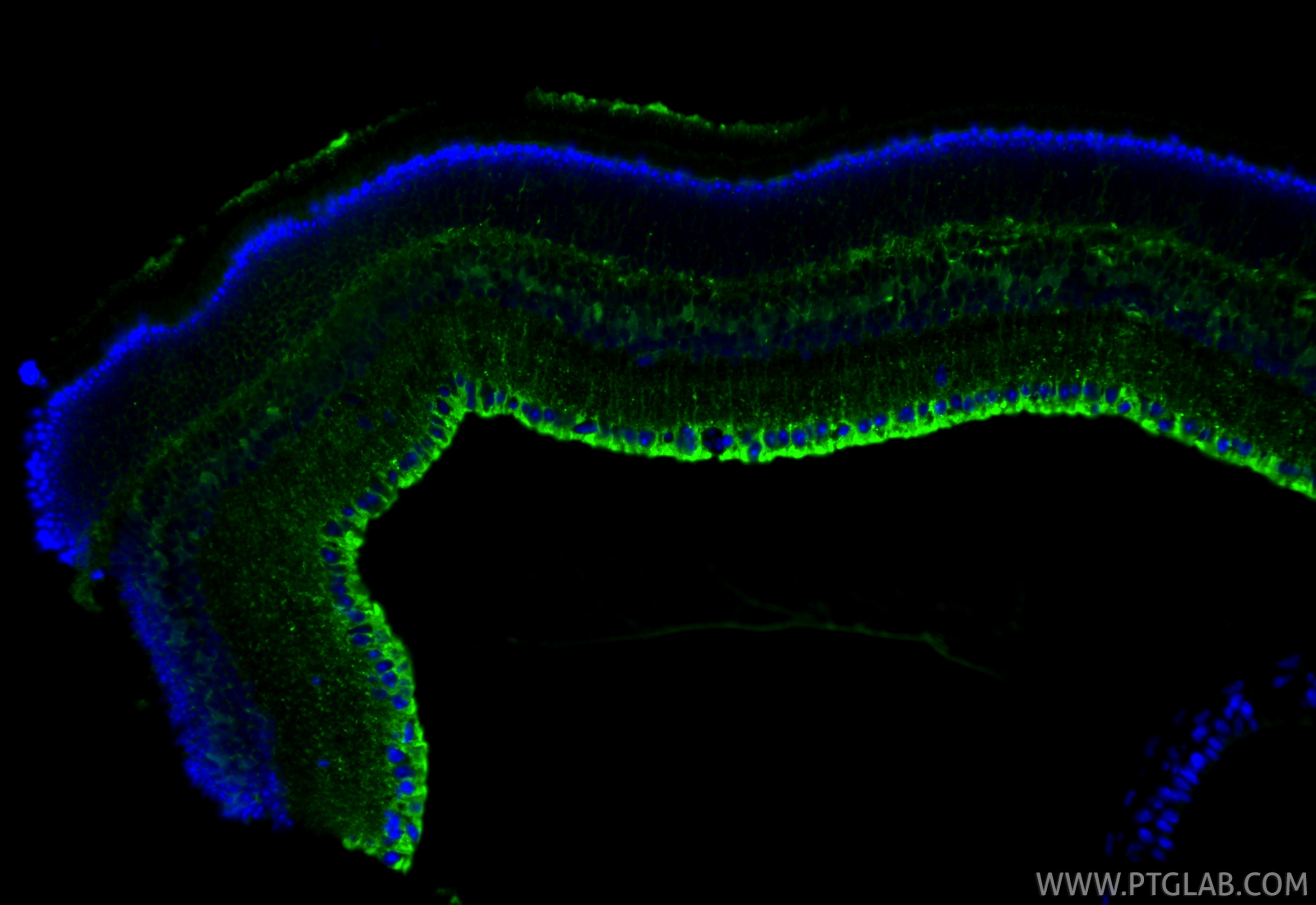 Immunofluorescence (IF) / fluorescent staining of mouse eye tissue using RLBP1 Recombinant monoclonal antibody (85697-1-RR)