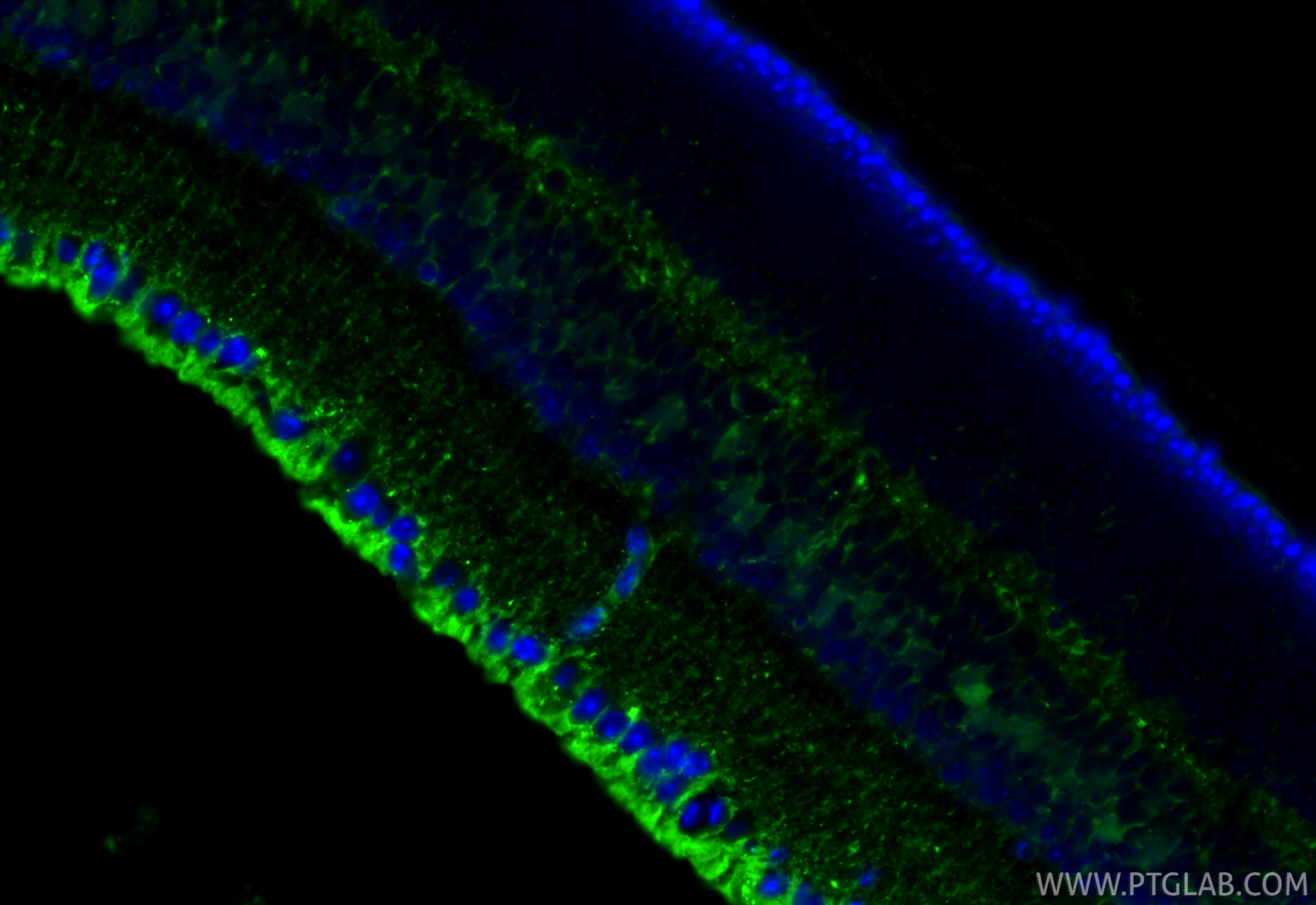 Immunofluorescence (IF) / fluorescent staining of mouse eye tissue using RLBP1 Recombinant monoclonal antibody (85697-1-RR)