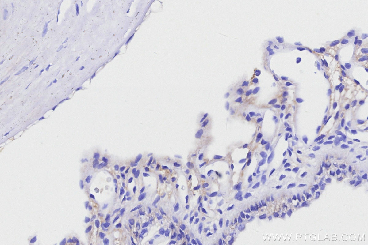 IHC staining of rat eye using 85697-1-RR Immunohistochemistry (IHC) staining of rat eye tissue using RLBP1 Recombinant monoclonal antibody (85697-1-RR)
