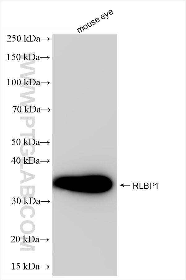RLBP1