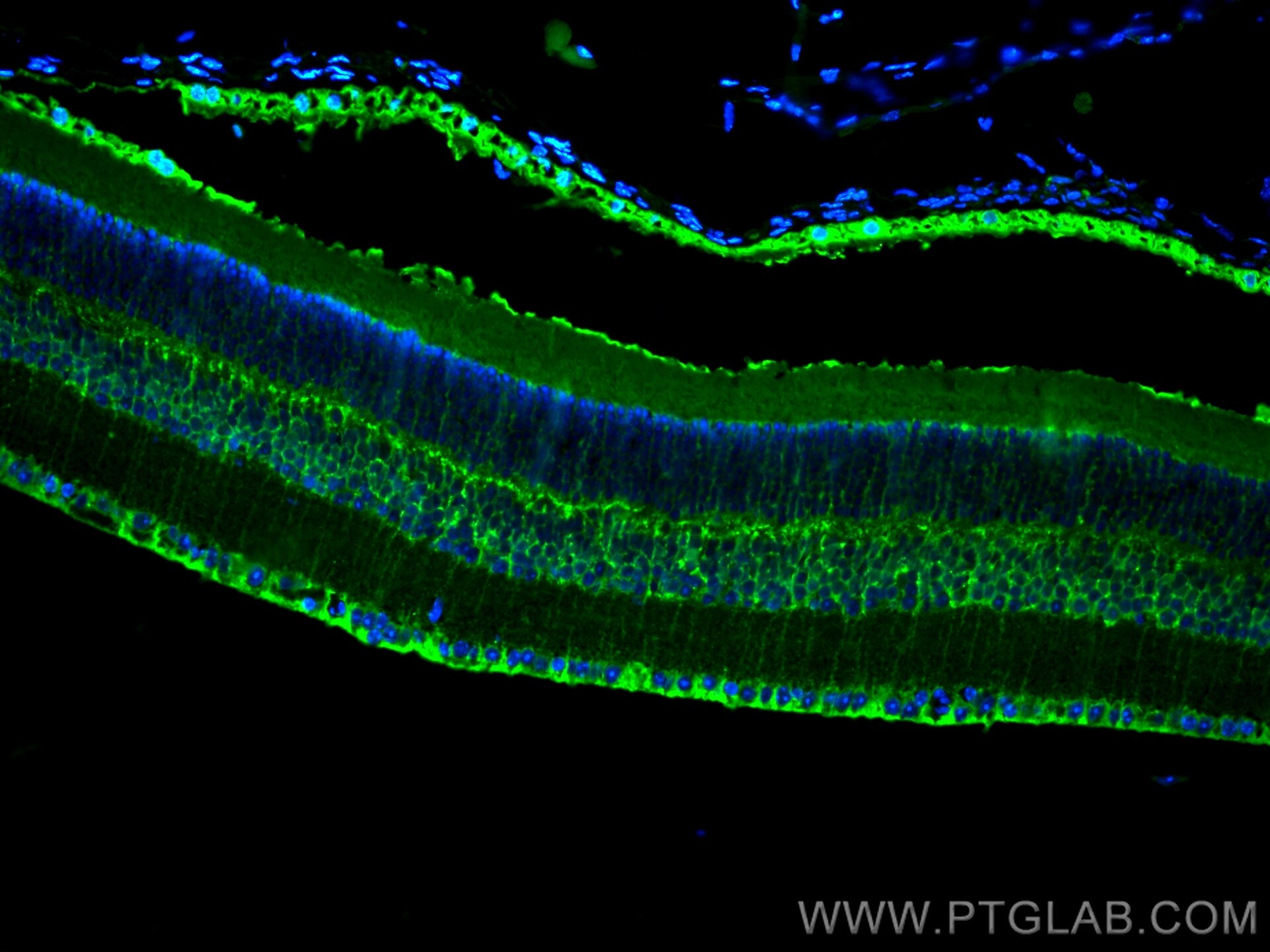 IF Staining of mouse eye using CL488-15356