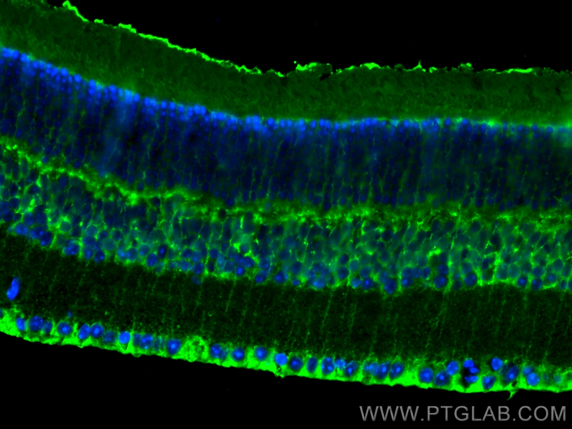 IF Staining of mouse eye using CL488-15356