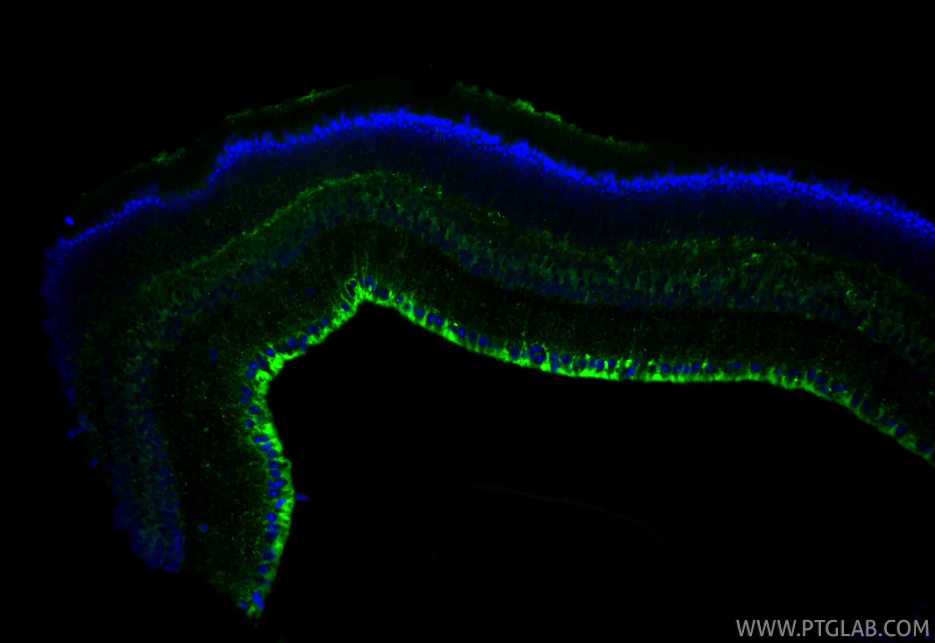 Immunofluorescent analysis of (4% PFA) fixed paraffin-embedded mouse eye tissue using CoraLite® Plus 488 RLBP1 antibody (CL488-85697, Clone: 242989D1 ) at dilution of 1:200. Heat mediated antigen retrieval with Tris-EDTA buffer (pH 9.0). Immunofluorescence (IF) / fluorescent staining of mouse eye tissue using CoraLite® Plus 488-conjugated RLBP1 Recombinant mo (CL488-85697)