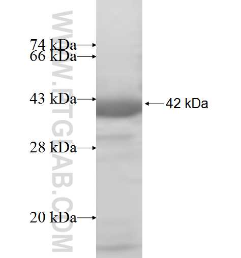 RLBP1 fusion protein Ag7498 SDS-PAGE