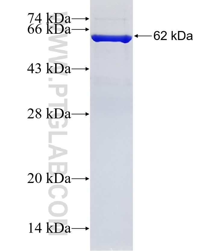 RLBP1 fusion protein Ag7602 SDS-PAGE