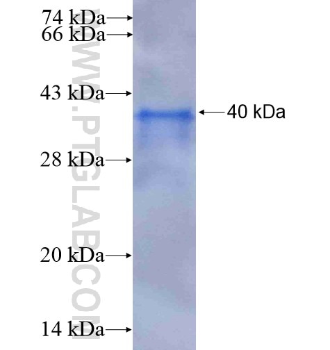RLBP1L1 fusion protein Ag5247 SDS-PAGE RLBP1L1 fusion protein Ag5247 SDS-PAGE