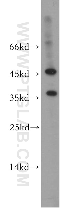 Western Blot (WB) analysis of Jurkat cells using RLBP1L2 Polyclonal antibody (21394-1-AP)