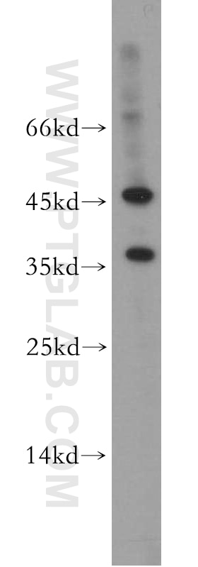 WB analysis of Jurkat using 21394-1-AP