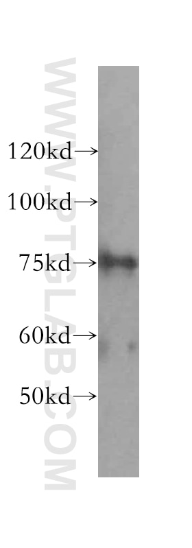 Western Blot (WB) analysis of HeLa cells using RLIM Polyclonal antibody (16121-1-AP)