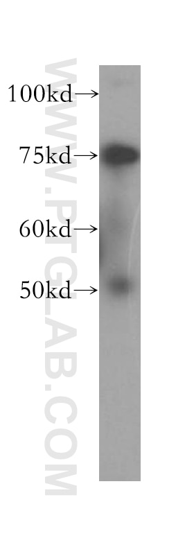 Western Blot (WB) analysis of Jurkat cells using RLIM Polyclonal antibody (16121-1-AP)