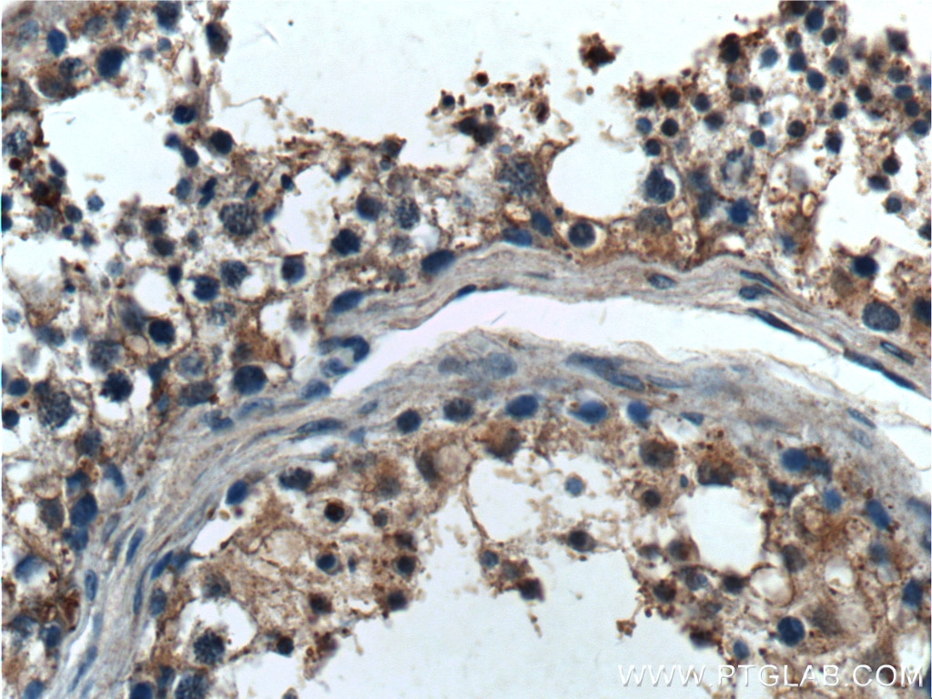 Immunohistochemistry (IHC) staining of human testis tissue using RLN1 Polyclonal antibody (23852-1-AP)