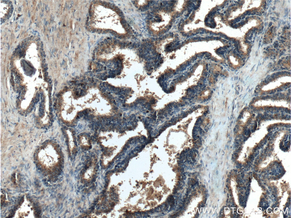 Immunohistochemistry (IHC) staining of human prostate hyperplasia tissue using RLN1 Polyclonal antibody (23852-1-AP)