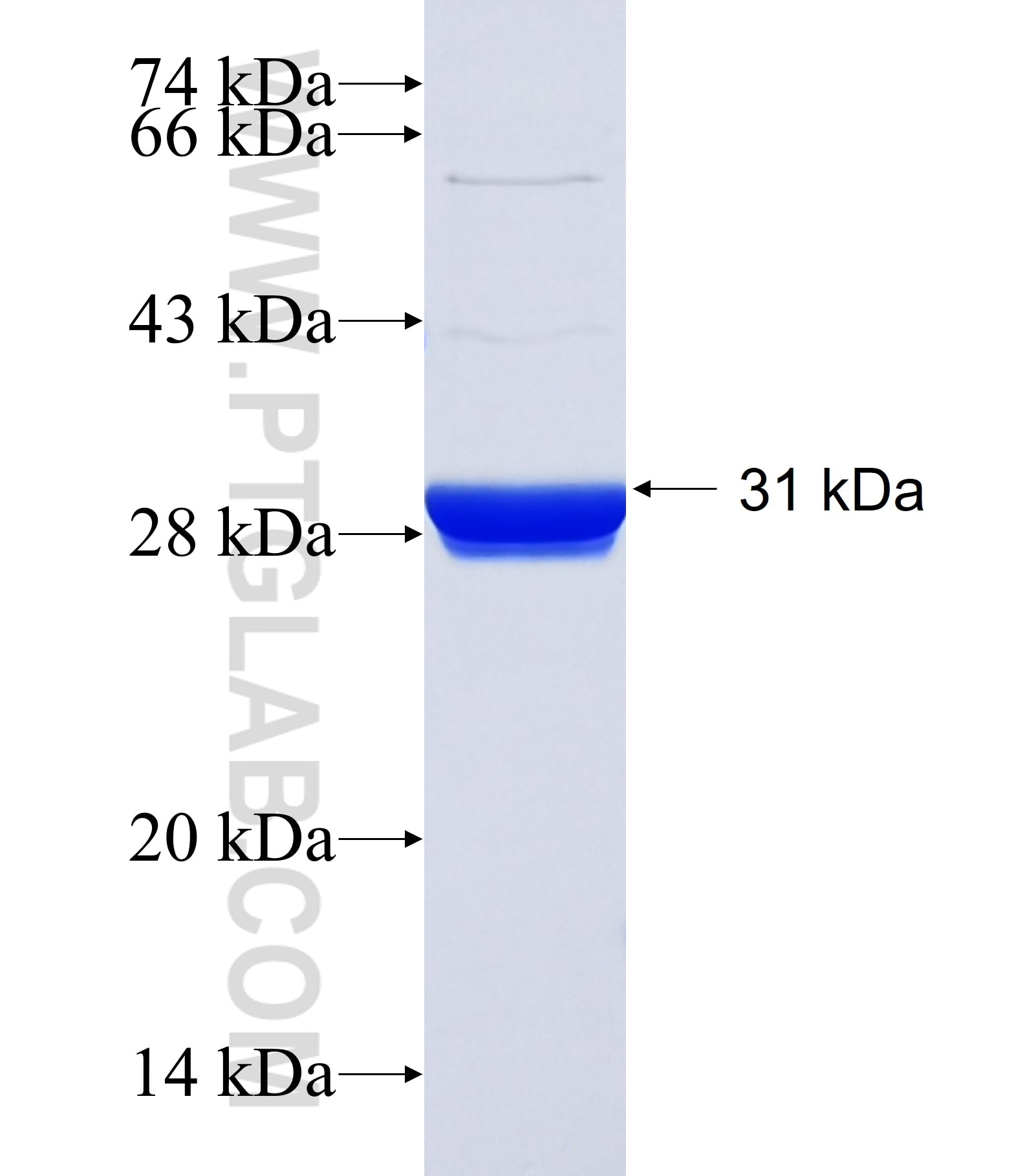 RLN2 fusion protein Ag18781 SDS-PAGE