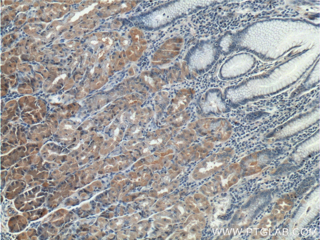 Immunohistochemistry (IHC) staining of human stomach tissue using RLN3 Polyclonal antibody (26075-1-AP)