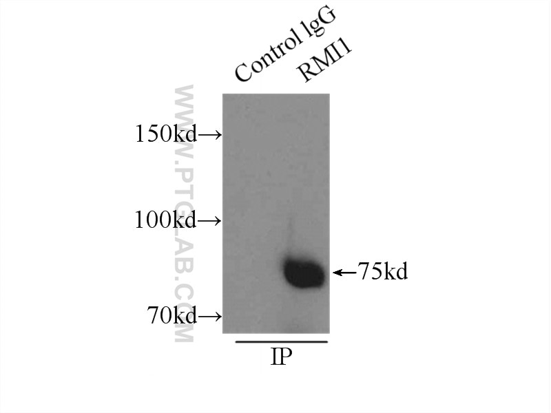 Immunoprecipitation (IP) experiment of HeLa cells using RMI1 Polyclonal antibody (14630-1-AP)