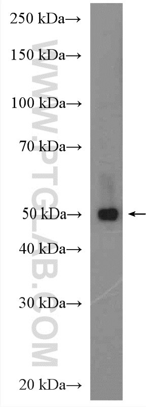 Western Blot (WB) analysis of human plasma using RMND5A Polyclonal antibody (17559-1-AP)