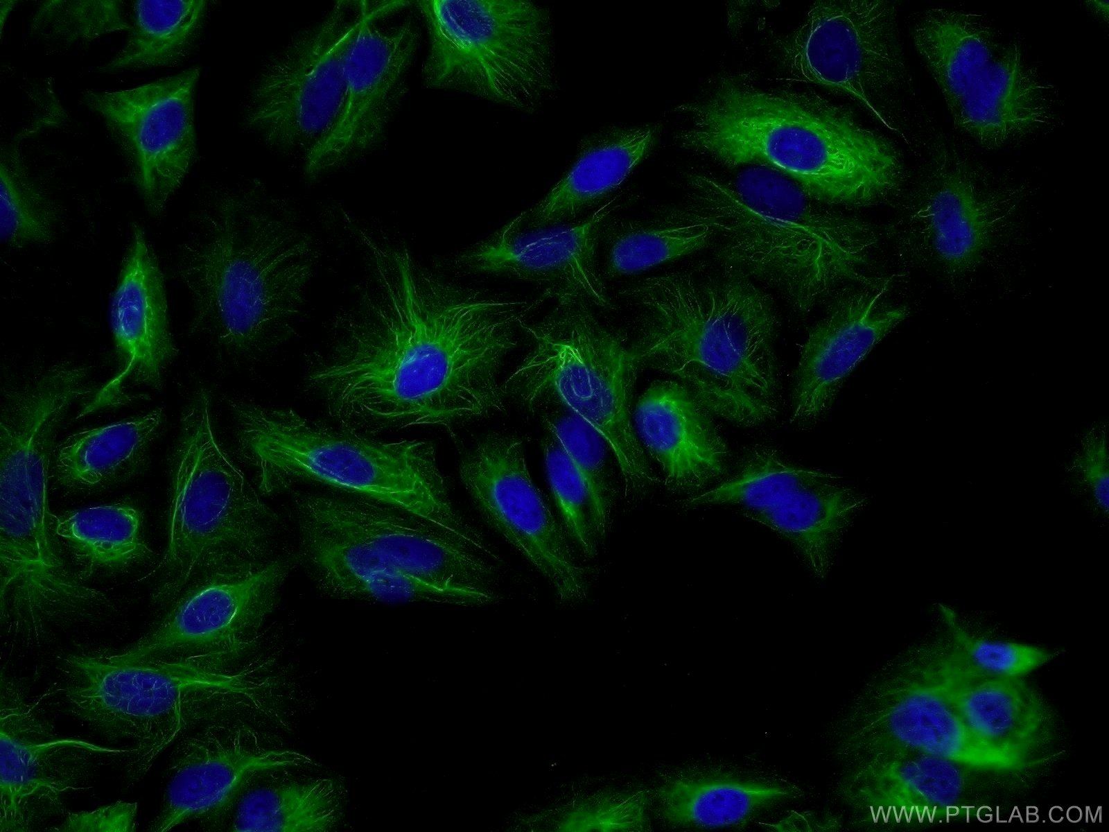 Immunofluorescence (IF) / fluorescent staining of A549 cells using RMND5B Polyclonal antibody (25803-1-AP)