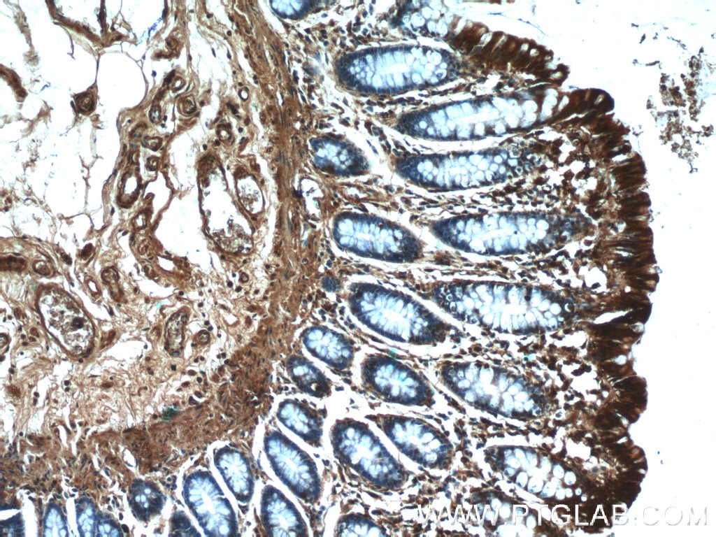 Immunohistochemistry (IHC) staining of human colon tissue using RMND5B Polyclonal antibody (25803-1-AP)