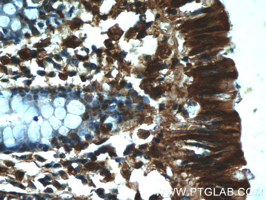 Immunohistochemistry (IHC) staining of human colon tissue using RMND5B Polyclonal antibody (25803-1-AP)