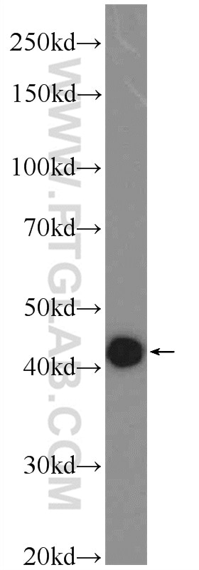 WB analysis of A549 using 25803-1-AP