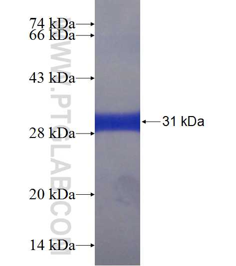 RMND5B fusion protein Ag22714 SDS-PAGE