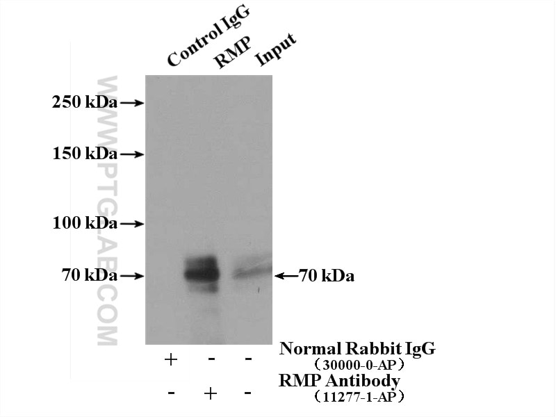 Immunoprecipitation (IP) experiment of HeLa cells using RMP Polyclonal antibody (11277-1-AP)