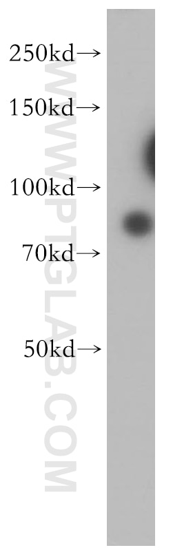 Western Blot (WB) analysis of Jurkat cells using RMP Polyclonal antibody (11277-1-AP)