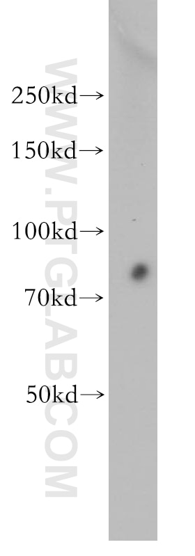 Western Blot (WB) analysis of HEK-293 cells using RMP Polyclonal antibody (11277-1-AP)