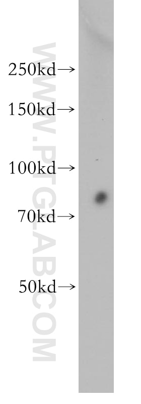 WB analysis of HEK-293 using 11277-1-AP