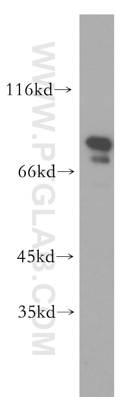 Western Blot (WB) analysis of HeLa cells using RMP Polyclonal antibody (11277-1-AP)