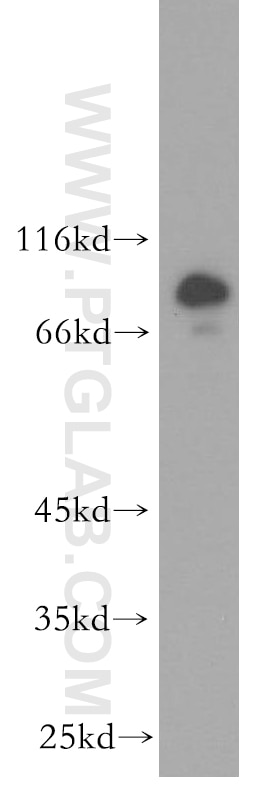 Western Blot (WB) analysis of HepG2 cells using RMP Polyclonal antibody (11277-1-AP)