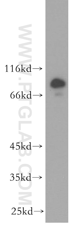 WB analysis of HepG2 using 11277-1-AP