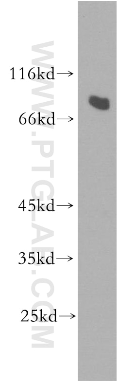 Western Blot (WB) analysis of A549 cells using RMP Polyclonal antibody (11277-1-AP)