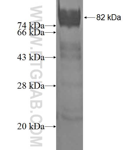 RMP fusion protein Ag1789 SDS-PAGE