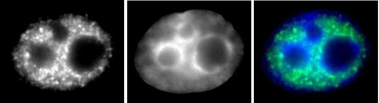 RNA pol II phospho Ser5 antibody (mAb) (Clone 1H4B6) tested by Immunofluorescence. Left: HeLa cell stained with RNA pol II CTD phospho Ser5 antibody (mAb). Middle: DAPI. Right: Merge.