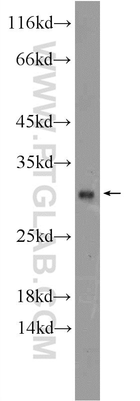 Western Blot (WB) analysis of human testis tissue using RNASE11 Polyclonal antibody (17203-1-AP)