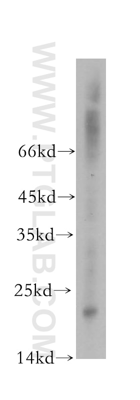 Western Blot (WB) analysis of mouse liver tissue using RNASE13 Polyclonal antibody (18408-1-AP)