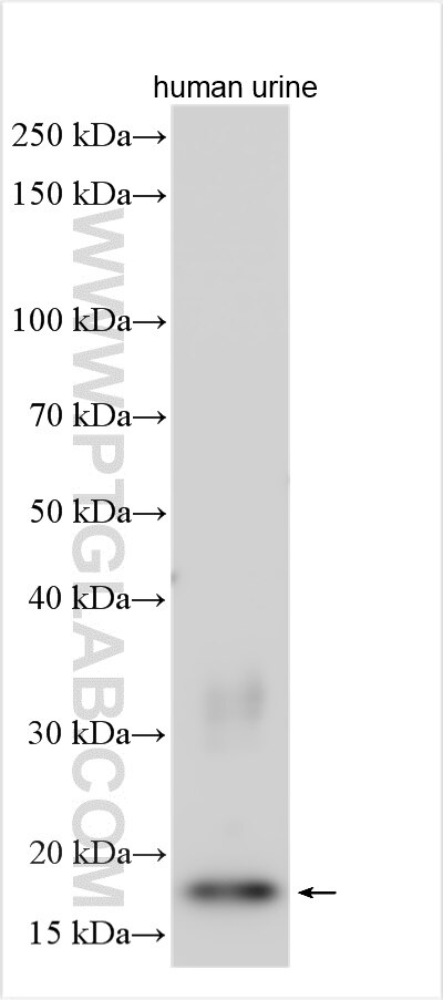 Western Blot (WB) analysis of various lysates using RNASE2 Polyclonal antibody (18172-1-AP)