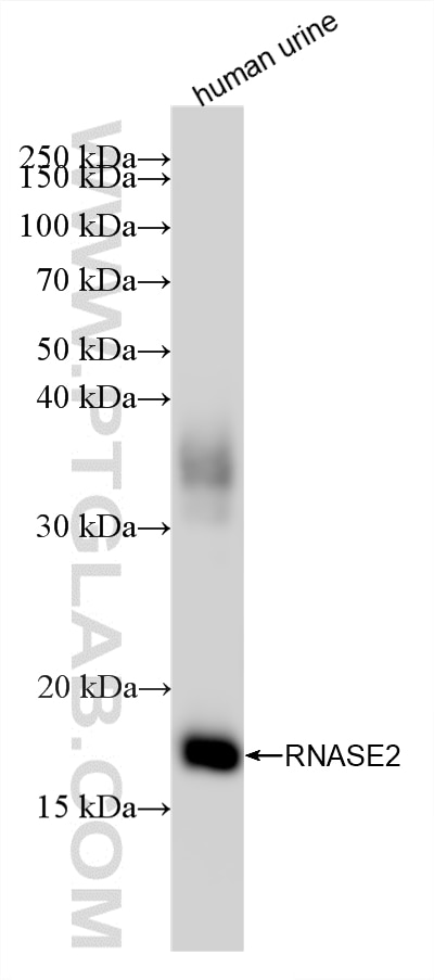 WB analysis of human urine using 88054-1-RR (same clone as 88054-1-PBS) Western Blot (WB) analysis of human urine sample using RNASE2 Recombinant monoclonal antibody (88054-1-RR)