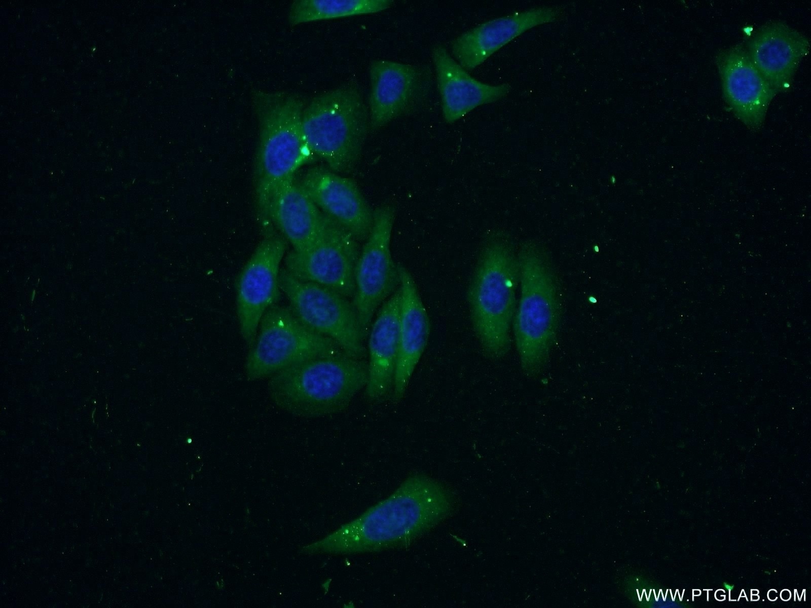 IF Staining of HepG2 using 55338-1-AP