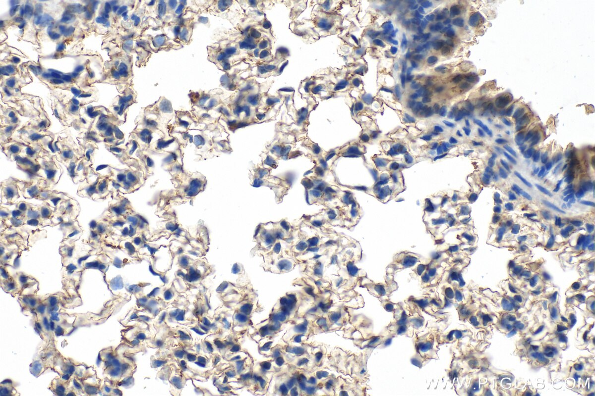 Immunohistochemistry (IHC) staining of rat lung tissue using RNASE4 Polyclonal antibody (30732-1-AP)