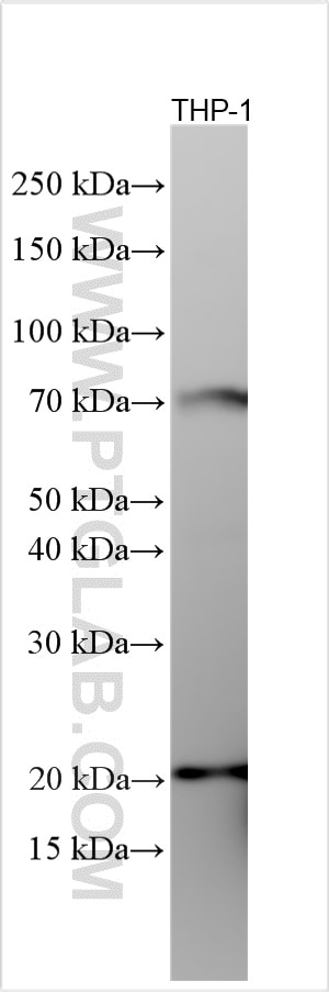 Western Blot (WB) analysis of various lysates using RNASE4 Polyclonal antibody (30732-1-AP)