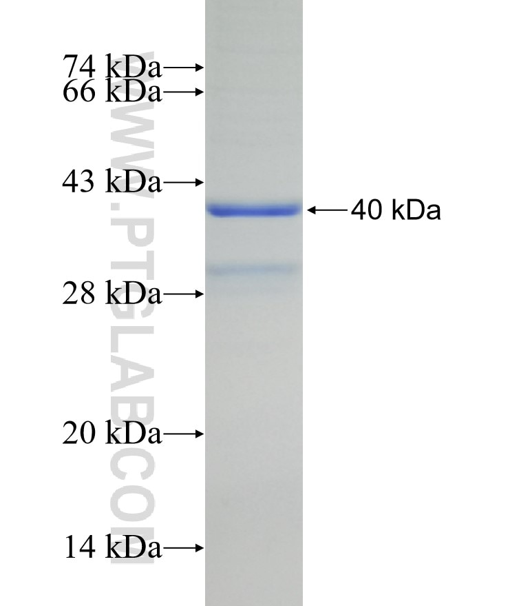 RNASE4 fusion protein Ag29272 SDS-PAGE