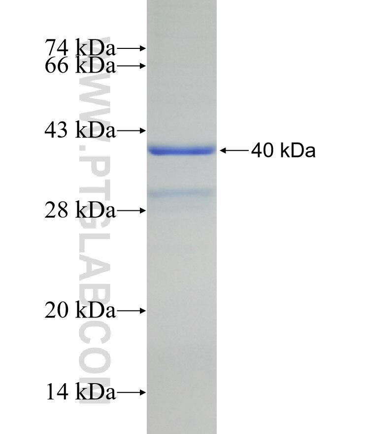 RNASE4 fusion protein Ag29272 SDS-PAGE