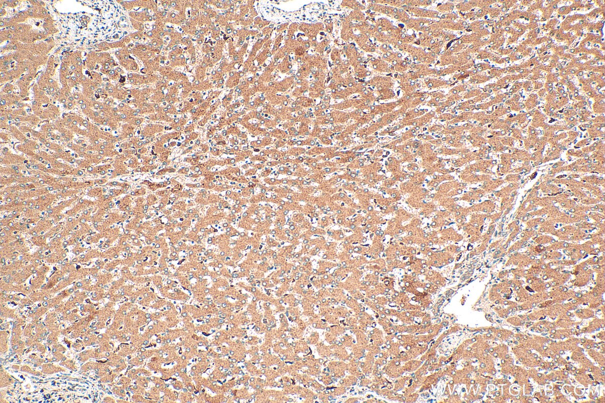Immunohistochemistry (IHC) staining of human liver tissue using RNASE6 Polyclonal antibody (16425-1-AP)