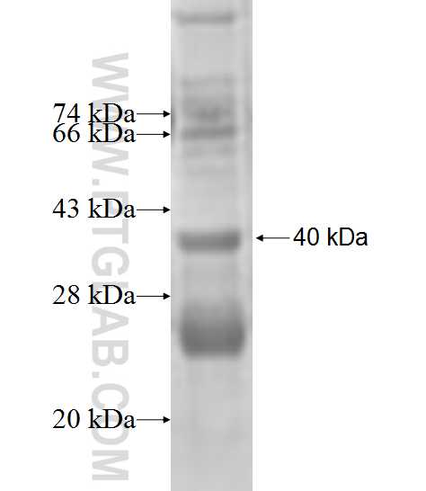 RNASE6 fusion protein Ag9667 SDS-PAGE