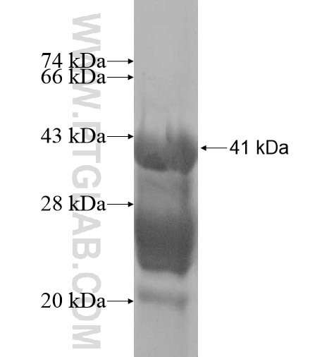 RNASE7 fusion protein Ag12534 SDS-PAGE