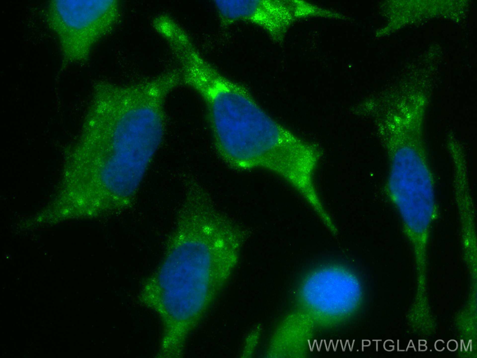 Immunofluorescence (IF) / fluorescent staining of HeLa cells using RNASEH1 Polyclonal antibody (15606-1-AP)